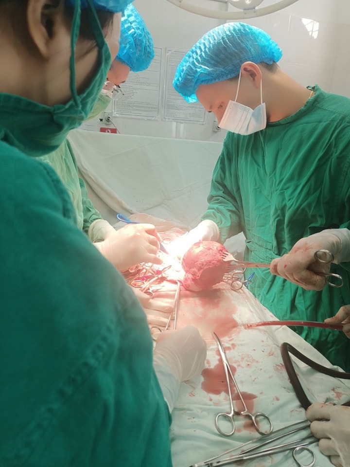 PHẪU THUẬT BỆNH NHÂN U XƠ TỬ CUNG TO TƯƠNG ĐƯƠNG THAI 20 TUẦN